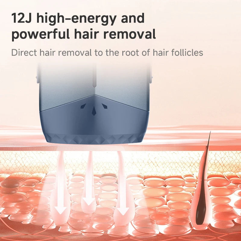 Mlay T18 ICE IPL Hair Removal Device Painless Home Use