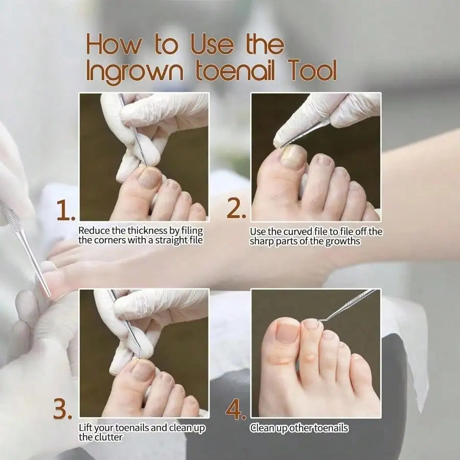 Stainless Steel Nail Stain Removal Tool Set Pedicure File