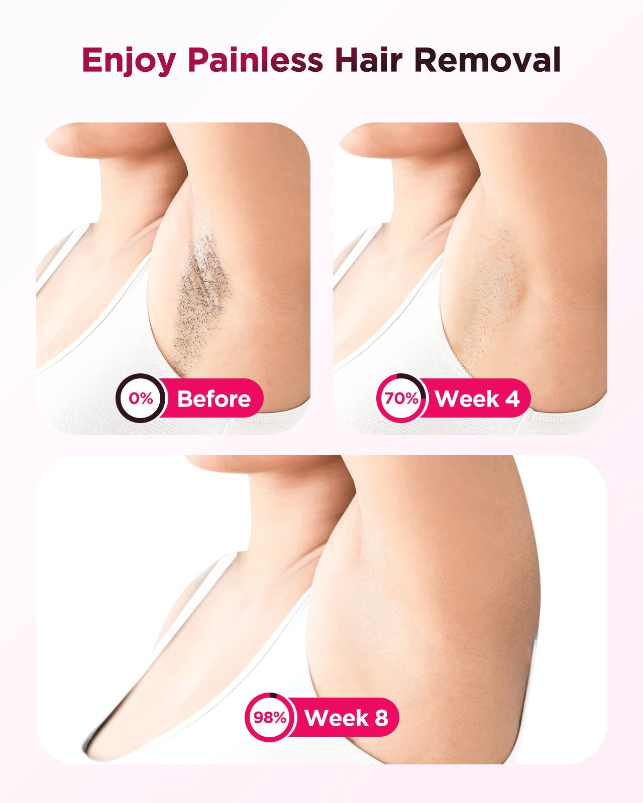 Totmizby Flash Laser Epilator IPL Hair Removal Machine